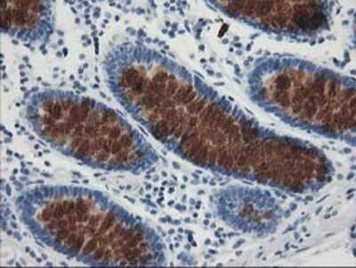 Immunohistochemistry: AP2M1 Antibody (OTI1E9) - Azide and BSA Free [NBP2-70417]