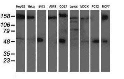 Western Blot: AP2M1 Antibody (OTI1E9)Azide and BSA Free [NBP2-70417]
