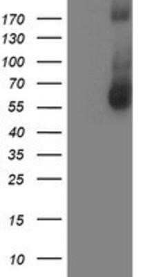 Western Blot: AP2M1 Antibody (OTI1E9)Azide and BSA Free [NBP2-70417]