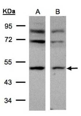 Western Blot: AP2M1 Antibody [NBP1-32272]