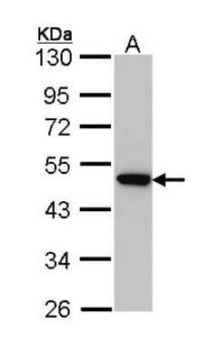 Western Blot: AP2M1 Antibody [NBP2-15418]