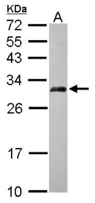 Western Blot: AP3M2 Antibody [NBP2-15419]