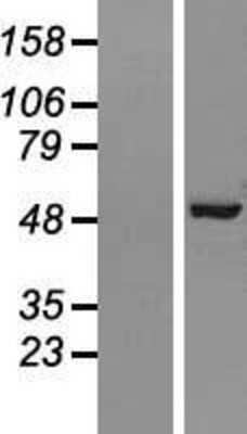 Western Blot: AP2M1 Overexpression Lysate [NBL1-07580]