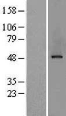 Western Blot: AP2M1 Overexpression Lysate [NBL1-07581]