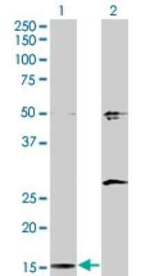 Western Blot: AP2S1 Antibody (3E4) [H00001175-M01]