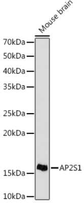 Western Blot: AP2S1 Antibody (4G1G1) [NBP3-16796]