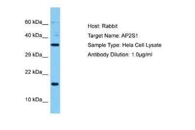 Western Blot: AP2S1 Antibody [NBP2-83937]