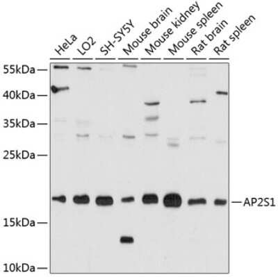 Western Blot: AP2S1 AntibodyAzide and BSA Free [NBP2-92072]