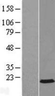 Western Blot: AP2S1 Overexpression Lysate [NBL1-07582]