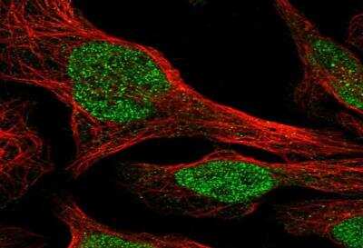 Immunocytochemistry/ Immunofluorescence: AP3B1 Antibody [NBP1-89228]