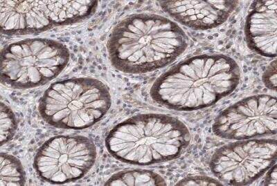 Immunohistochemistry-Paraffin: AP3B1 Antibody [NBP1-89228]