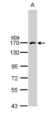 Western Blot: AP3B1 Antibody [NBP1-33723]