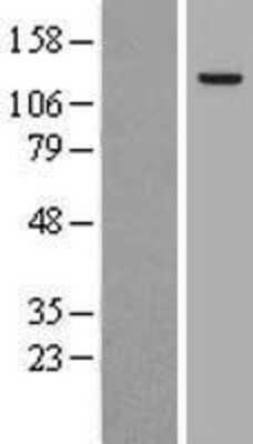 Western Blot: AP3B1 Overexpression Lysate [NBL1-07583]