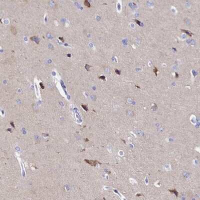 Immunohistochemistry-Paraffin: AP3B2 Antibody [NBP1-81011]