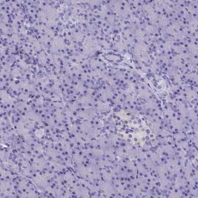 Immunohistochemistry-Paraffin: AP3B2 Antibody [NBP1-81011]