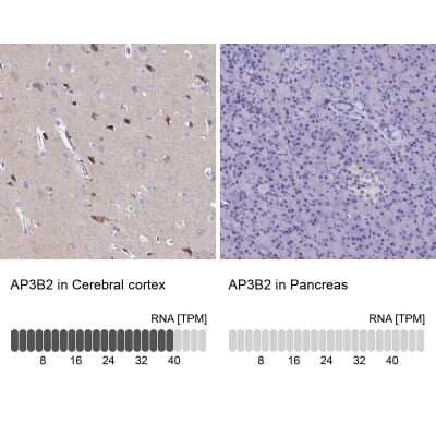 Immunohistochemistry-Paraffin: AP3B2 Antibody [NBP1-81011]