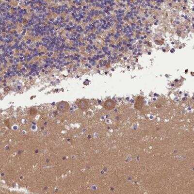 Immunohistochemistry-Paraffin: AP3B2 Antibody [NBP1-81012]