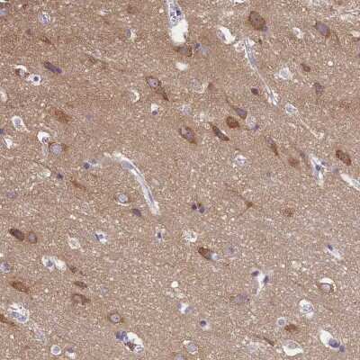Immunohistochemistry-Paraffin: AP3B2 Antibody [NBP1-81012]
