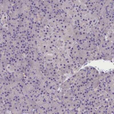 Immunohistochemistry-Paraffin: AP3B2 Antibody [NBP1-81012]