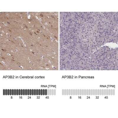 Immunohistochemistry-Paraffin: AP3B2 Antibody [NBP1-81012]