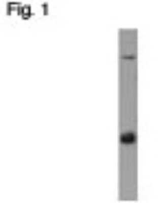 Western Blot: AP3B2 Antibody [NB100-74370]