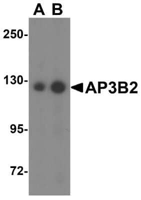 Western Blot: AP3B2 AntibodyBSA Free [NBP1-76590]