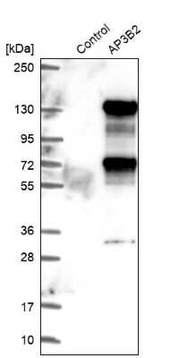 Western Blot: AP3B2 Antibody [NBP1-81011]