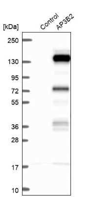 Western Blot: AP3B2 Antibody [NBP1-81012]