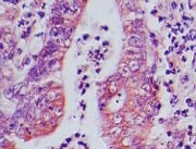 Immunohistochemistry-Paraffin: AP3D1 Antibody [NBP2-27158]