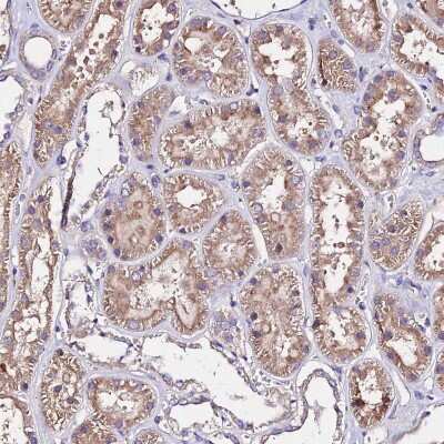 Immunohistochemistry: AP3M1 Antibody [NBP2-48834]