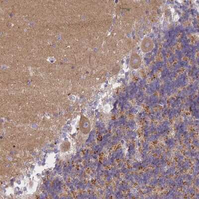 Immunohistochemistry: AP3M1 Antibody [NBP2-48904]