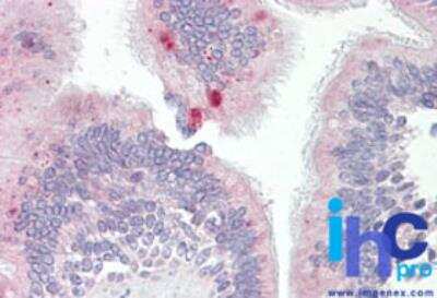 Immunohistochemistry-Paraffin: AP3M1 Antibody [NBP2-27068]