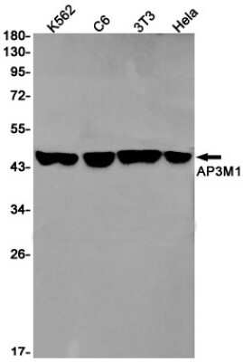 Western Blot: AP3M1 Antibody (S08-8D2) [NBP3-14997]