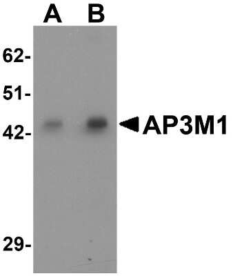 Western Blot: AP3M1 AntibodyBSA Free [NBP1-76589]