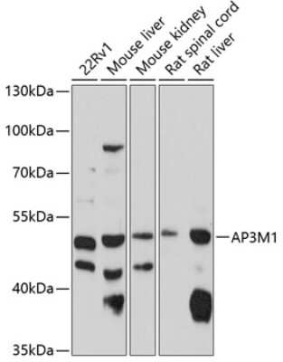 Western Blot: AP3M1 AntibodyBSA Free [NBP2-92018]