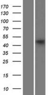 Western Blot: AP3M1 Overexpression Lysate [NBP2-04515]