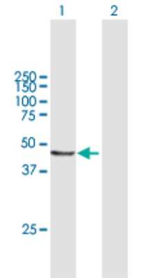 Western Blot: AP3M2 Antibody [H00010947-B01P]