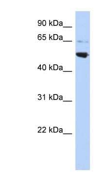 Western Blot: AP3M2 Antibody [NBP1-56624]