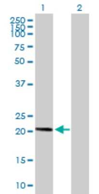 Western Blot: AP3S1 Antibody [H00001176-B02P]