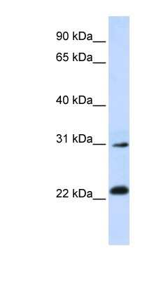 Western Blot: AP3S1 Antibody [NBP1-55449]