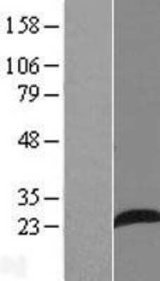 Western Blot: AP3S1 Overexpression Lysate [NBL1-07586]