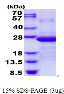 SDS-PAGE: Recombinant Human AP3S1 His Protein [NBP2-22678]