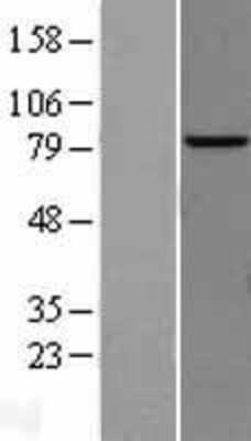 Western Blot: AP4B1 Overexpression Lysate [NBL1-07588]