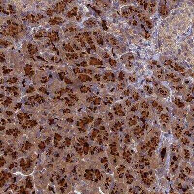 Immunohistochemistry: AP4E1 Antibody [NBP1-89057]