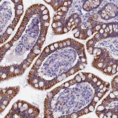 Immunohistochemistry-Paraffin: AP4E1 Antibody [NBP1-89056]