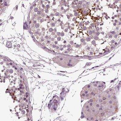 Immunohistochemistry: AP4M1 Antibody [NBP2-56456]