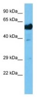 Western Blot: AP4M1 Antibody [NBP3-10822]