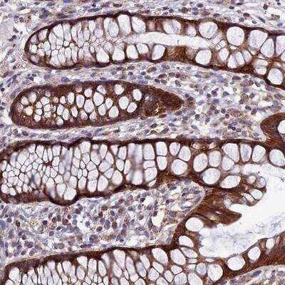 Immunohistochemistry-Paraffin: AP4S1 Antibody [NBP1-89058]