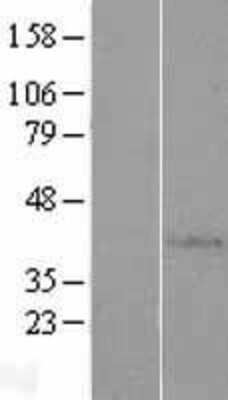 Western Blot: AP4S1 Overexpression Lysate [NBP2-07535]