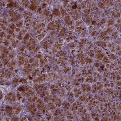 Immunohistochemistry-Paraffin: AP5B1 Antibody [NBP2-49531]